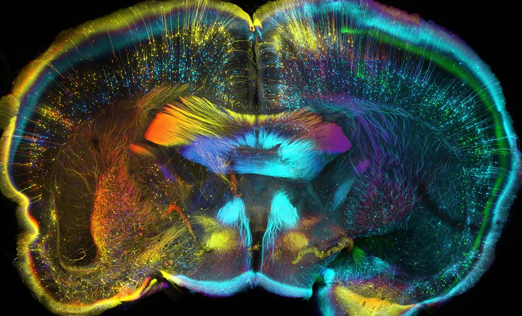 This confocal micrograph shows the nerves in a cross-section of an adult mouse's brain